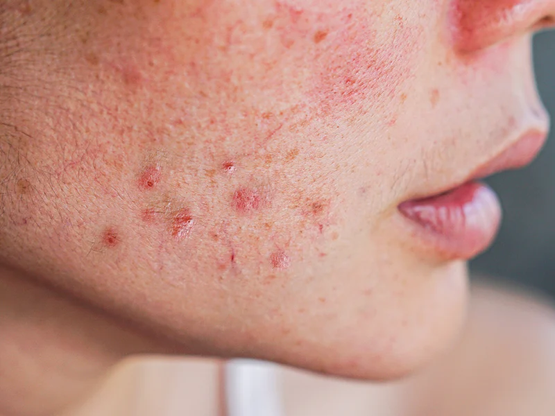 Consulta de dermatologia clínica